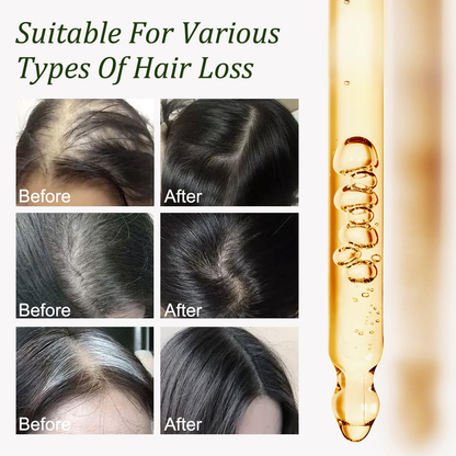 🎉Buy One Get One Free🎁 - ✨💆Alcuras® Pure Batana & Rosemary Hair Oil💇